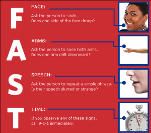 stroke-fast